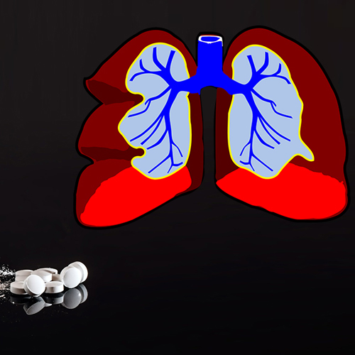 Respiratory System Drugs